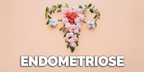 Endometriose